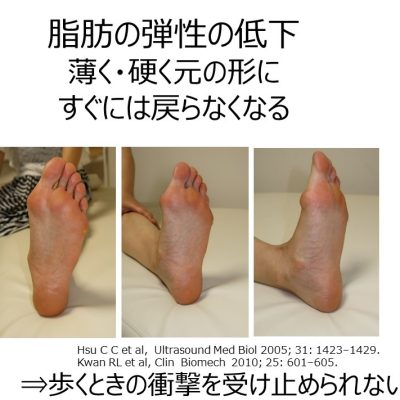 女性の足の裏のタコについて 一般社団法人足の番人 足の知識 活動報告