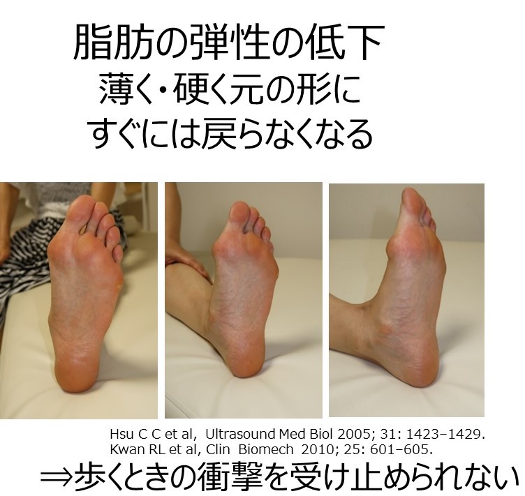 年を取ると足の皮膚と脂肪が硬くなる！？〜困った編〜 - 一般